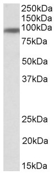 Anti-Transferrin Receptor antibody (ab166929) at 1 µg/ml + Human Breast lysate at 35 µgdeveloped using the ECL technique