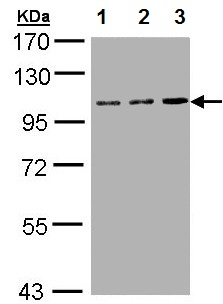 All lanes : Anti-Transferrin Receptor antibody (ab137844) at 1/1000 dilutionLane 1 : HepG2 whole cell lysateLane 2 : Molt 4 whole cell lysateLane 3 : Raji whole cell lysateLysates/proteins at 30 µg per lane.