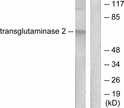 All lanes : Anti-Transglutaminase 2 antibody (ab53171) at 1/500 dilutionLane 1 : HuvEc cell extracts minus immunising peptideLane 2 : HuvEc cell extracts plus immunising peptide