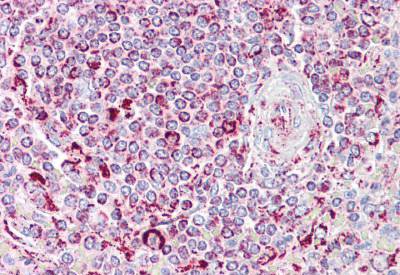 Immunohistochemical analysis of formalin fixed, paraffin-embedded Human spleen tissue labelling Transglutaminase 5 with ab133786 at 5 µg/ml. Primary antibody labelling was followed by a biotinylated Goat anti-Rabbit IgG secondary antibody, alkaline phosphatase-streptavidin and chromogen.