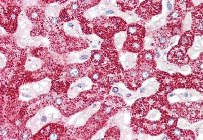 Immunohistochemical analysis of formalin fixed, paraffin-embedded Human liver tissue labelling Transglutaminase 5 with ab133786 at 5 µg/ml. Primary antibody labelling was followed by a biotinylated Goat anti-Rabbit IgG secondary antibody, alkaline phosphatase-streptavidin and chromogen.