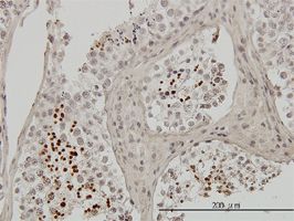 ab58269 used in immunohistochemistry at 3ug/ml on formalin fixed and paraffin embedded human testis.