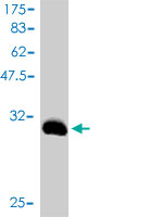 Western blot against tagged recombinant protein immunogen using ab58269 at 1ug/ml.
