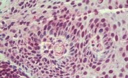 Immunohistochemical analysis of formalin-fixed, paraffin-embedded Human tonsil tissue labeling Translin with ab190241 at 5 µg/ml.