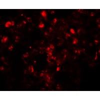 Immunofluorescent analysis of Human lung tissue labeling Translin with ab190241 at 20 µg/ml.