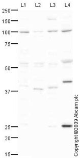 All lanes : Anti-Transportin 1 antibody (ab67352) at 1 µg/mlLane 1 : Liver (Mouse) Tissue LysateLane 2 : Kidney (Mouse) Tissue LysateLane 3 : Liver (Rat) Tissue LysateLane 4 : Pancreas (Mouse) Tissue LysateLysates/proteins at 10 µg per lane.SecondaryGoat polyclonal to Rabbit IgG - H&L - Pre-Adsorbed (HRP) at 1/3000 dilutiondeveloped using the ECL techniquePerformed under reducing conditions.
