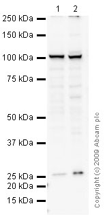 All lanes : Anti-Transportin 1 antibody [D45] (ab10303) at 5 µg/mlLane 1 : HeLa (Human epithelial carcinoma cell line) Whole Cell Lysate Lane 2 : SW480 (Human colon adenocarcinoma cell line) Whole Cell Lysate Lysates/proteins at 10 µg per lane.SecondaryGoat polyclonal to Mouse IgG - H&L - Pre-Adsorbed (HRP) at 1/3000 dilution