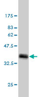 Western blot against tagged recombinant protein immunogen using ab58140 TRAP220/MED1 antibody at 1ug/ml. 