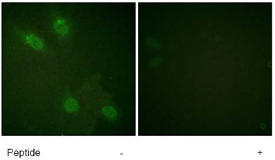 ab61119, at a 1/50 dilution, staining human TRAP220/MED1 in HeLa cells with (+) or without (-) immunising peptide, using Immunofluorescence