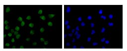 Immunofluorescent analysis of HeLa cells (-20°C Acetone-fixed) labeling TRAX with ab181862 at 1/100 dilution followed by Goat anti rabbit IgG (Alexa Fluor®488) secondary at 1/200 dilution and counter-stained with DAPI (blue).