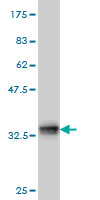 Western blot against tagged recombinant protein immunogen using ab57683 Treacher Collins syndrome protein antibody at 1ug/ml.
