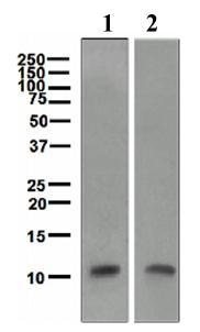 All lanes : Anti-Trefoil Factor 3 antibody [EPR3973] (ab109104) at 1/1000 dilutionLane 1 : Human uterus cancer lysateLane 2 : Human colon cancer lysateLysates/proteins at 10 µg per lane.