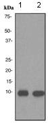 All lanes : Anti-Trefoil Factor 3 antibody [EPR3974] (ab108599) at 1/1000 dilution (unpurified)Lane 1 : Human small intestine tissue lysateLane 2 : Human uterus tissue lysateLysates/proteins at 10 µg per lane.