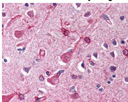 Ab64188 (2.5ug/ml) staining human SIN1 in human brain, cortex tissue by immunohistochemistry using formalin fixed, paraffin embedded tissue.