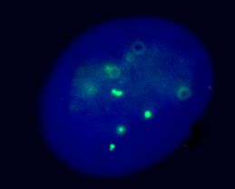 Immunofluorescent imaging of human cells (U2OS) with ab10579 confirms the specificity of this antibody.  A few intense nuclear foci are seen in interphase cells, corresponding to telomeric localisation.  The complete absence of background nuclear or cytoplasmic staining confirms the specificity of this antibody. This image is in exact agreement with numerous published reports. IF was performed with a standard paraformaldehyde technique (fixed in PBS buffered PFH 4% for 5 minutes, permeabilised with 0.5% triton-PBS for 5 minutes, blocked with 5% milk / 0.2% tween for one hour.  Primary antibody used at 1/100 in 5% milk / 0.2% TWEEN for one hour, secondary antibody for 30 minutes.  All blocking and incubation steps carried out at 37 degrees. Nuclei are visualised using Hoechst stain. 