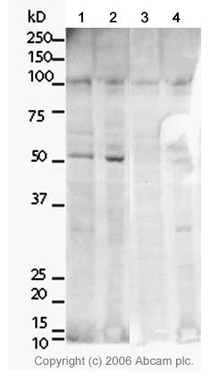 All lanes : Anti-TRF2 antibody (ab4182) at 1 µg/mlLane 1 : HeLa nuclear extractLane 2 : HeLa whole cell lysateLane 3 : HeLa nuclear lysate with Human TRF2 peptide (ab13765) at 1 µg/mlLane 4 : HeLa whole cell lysate with Human TRF2 peptide (ab13765) at 1 µg/mlLysates/proteins at 20 µg per lane.SecondaryGoat Anti-Rabbit IgG H&L (HRP) (ab6721) at 1/5000 dilution
