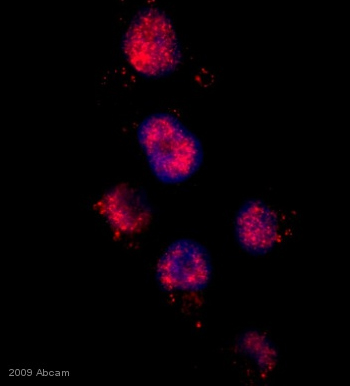 ab4182 staining TRF2 in human Breast carcinoma cells by Immunocytochemistry/ Immunofluorescence. Cells were fixed with paraformaldehyde, permeabilized with 0.5% Triton-x100 and blocking with 2% serum was performed for 30 minutes at 370C. Samples were incubated with primary antibody at 1/100 dilution in PBS for 2 hours at 37°C. An Alexa Fluor® 594 conjugated goat monoclonal to rabbit IgG was used at 1/75 dilution as secondary antibody.See Abreview