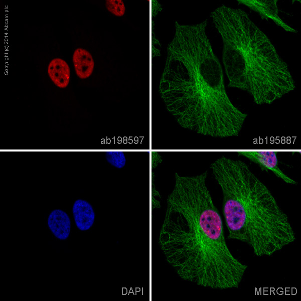 ab198597 staining TRF2 in HeLa cells. The cells were fixed with 4% formaldehyde (10 min), permeabilized with 0.1% Triton X-100 for 5 minutes and then blocked with 1% BSA/10% normal goat serum/0.3M glycine in 0.1% PBS-Tween for 1h. The cells were then incubated overnight at +4°C with ab198597 at 1/100 dilution (shown in red) and ab195887, Mouse monoclonal to alpha Tubulin (Alexa Fluor® 488), at 1/250 dilution (shown in green). Nuclear DNA was labelled with DAPI (shown in blue).Image was taken with a confocal microscope (Leica-Microsystems, TCS SP8).This product also gave a positive signal under the same testing conditions in HeLa cells fixed with 100% methanol (5min).