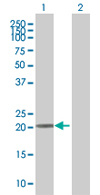 All lanes : Anti-TRFP / MED20 antibody (ab67800) at 1/500 dilutionLane 1 : TRFP / MED20 transfected 293T cell lysateLane 2 : Non-transfected 293T cell lysateLysates/proteins at 25 µg per lane.SecondaryGoat Anti-Mouse IgG (H&L)-HRP Conjugate at 1/2500 dilution
