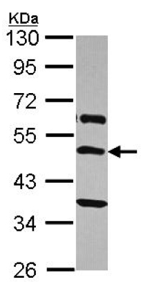 Anti-TRH Receptor antibody - C-terminal (ab151510) at 1/2000 dilution + A431 whole cell lysate at 30 µg
