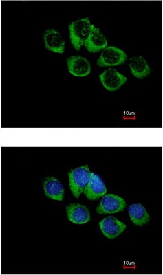 Immunofluorescent analysis of methanol-fixed A431 cells labeling TRH Receptor with ab151510 at 1/500 dilution. Lower image shows cells co-stained with Hoechst 33342.