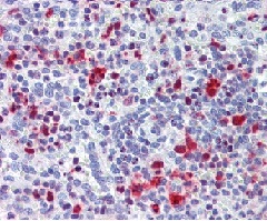 ab111057, at 3.75 ug/ml, staining TRIB2 in formalin-fixed, paraffin-embedded Human spleen tissue. After incubation with the primary antibody, slides were incubated with biotinylated secondary antibody LSD3, followed by alkaline phosphatase-streptavidin and chromogen.