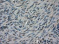 ab117981, at 1/50 dilution, staining TRIB2 in paraffin-embedded Human endometrium tissue by Immunohistochemistry.