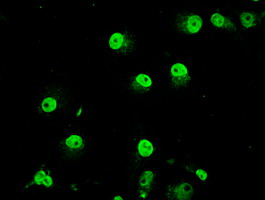 ab117981, at 1/50 dilution, staining TRIB2 in COS7 cells by Immunofluorescence.