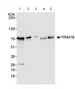 All lanes : Anti-TRIM16 antibody (ab72129) at 0.04 µg/mlLane 1 : Whole cell lysate from Hela cells at 50 µgLane 2 : Whole cell lysate from Hela cells at 15 µgLane 3 : Whole cell lysate from Hela cells at 5 µgLane 4 : Whole cell lysate from 293T cells at 50 µgLane 5 : Whole cell lysate from NIH3T3 cells at 50 µg