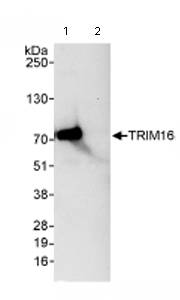 Immunoprecipitation/ Western Blot of TRIM16. Lane 1: ab72129 at 3µg/mg whole cell lysate. Lane 2: Control IgG. ab72129 at 1µg/ml for WB. Whole cell lysate from Hela cells at 1mg for IP, 20% of IP loaded. Detection:Chemiluminescence with an exposure time of 10 seconds.