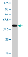 Western blot against tagged recombinant protein immunogen using ab56907 TRIM32 antibody at 1ug/ml.