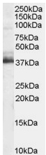 Anti-TRIM5 alpha antibody (ab4389) at 1 µg/ml + Human Brain lysate (RIPA buffer, 35µg total protein per lane).