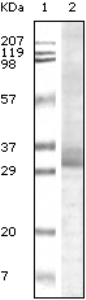All lanes : Anti-TRIM5 alpha antibody [3B11H2] (ab31956)Lane 1 : Molecular weight markerLane 2 : TRIM5-alpha recombinant protein (NB: truncated form)