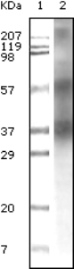 All lanes : Anti-TRIM5 alpha antibody [3B11H2] (ab31956)Lane 1 : Molecular weight markerLane 2 : Breast tissue lysate
