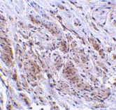 ab17203 at 2µg/ml staining TRIM5 gamma in human bladder tissue by IHC