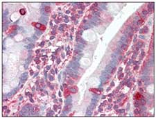 ab109763, at 2.5 µg/ml, staining TRIM5 gamma in formalin-fixed, paraffin-embedded Human Small Intestine tissue by immunohistochemistry. Sections were incubated with a biotinylated goat anti-rabbit IgG secondary antibody, followed by alkaline phosphatase-streptavidin and chromogen.