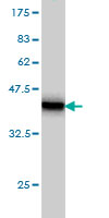 Western blot against tagged recombinant protein immunogen using ab57436 TRIM68 antibody at 1ug/ml.