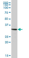 Anti-TRIM72 antibody (ab68061) at 1/500 dilution + Human liver tissue lysate at 25 µgSecondaryGoat anti-mouse IgG (H&L)-HRP conjugated at 1/2500 dilution
