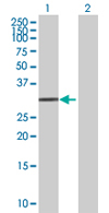 All lanes : Anti-TRIM72 antibody (ab68061) at 1/500 dilutionLane 1 : TRIM72 (aa1-269, isoform 2) transfected 293T cell lysateLane 2 : Non-transfected 293T cell lysateLysates/proteins at 25 µg per lane.SecondaryGoat Anti-Mouse IgG (H&L)-HRP Conjugate at 1/2500 dilution
