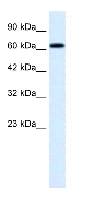 Anti-TRIM9 antibody (ab28463) at 0.5 µg/ml + HepG2 cell lysate