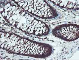 ab128109, at a dilution of 1/150, staining TRIP in paraffin-embedded Human colon tissue by Immunohistochemistry.