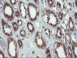 ab128109, at a dilution of 1/150, staining TRIP in paraffin-embedded Human kidney tissue by Immunohistochemistry.