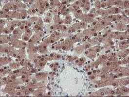 ab128109, at a dilution of 1/150, staining TRIP in paraffin-embedded Human liver tissue by Immunohistochemistry.