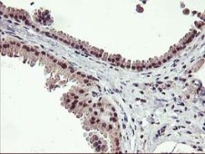 ab119779, at 1/150 dilution, staining Tristetraprolin in paraffin-embedded Human breast tissue by Immunohistochemistry.