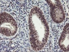 ab119779, at 1/150 dilution, staining Tristetraprolin in paraffin-embedded Human endometrium tissue by Immunohistochemistry.