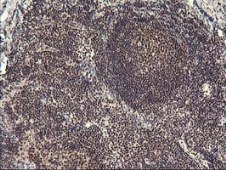 ab119779, at 1/150 dilution, staining Tristetraprolin in paraffin-embedded Human tonsil tissue by Immunohistochemistry.