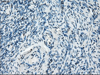 ab124024, at 1/50, staining Tristetraprolin in paraffin embedded Human ovary tissue by Immunohistochemistry.