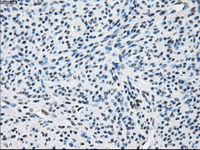 ab124024, at 1/50, staining Tristetraprolin in paraffin embedded Human endometrium tissue by Immunohistochemistry.
