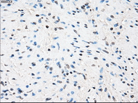 ab124024, at 1/50, staining Tristetraprolin in paraffin embedded Human prostate tissue by Immunohistochemistry.