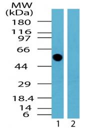 All lanes : Anti-TRK fused gene antibody (ab72126) at 0.5 µg/mlLane 1 : Human brain lysate Lane 2 : Human brain lysate with immunising peptide